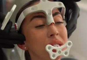 Modjaw 4D Motion (Аксіографія) - Стоматологія PICASSO, Ужгород