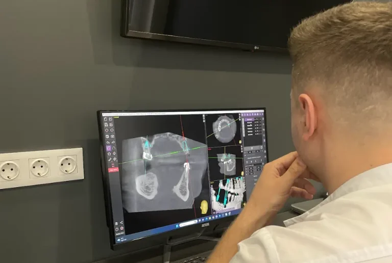 Найкраща стоматологія в Ужгороді - PICASSO Dental Clinic Вул. Бабʼяка (Бобяка), 1Б, ЖК «Crystal» +38 097 247 57 47